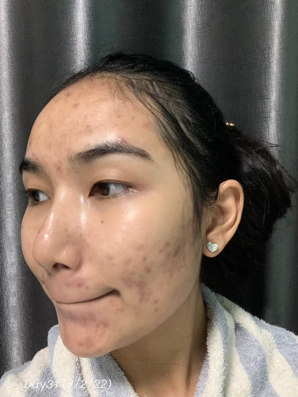 maXkin