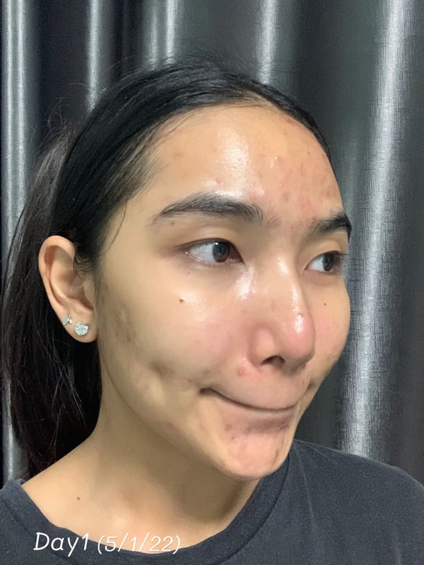 maXkin