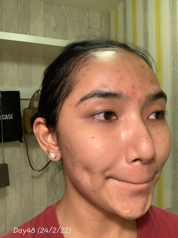 maXkin