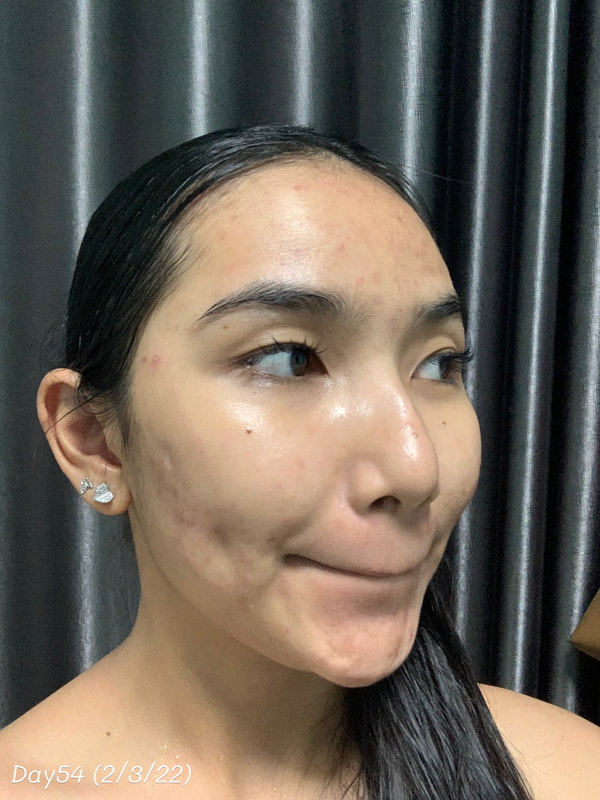 maXkin