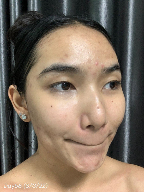maXkin