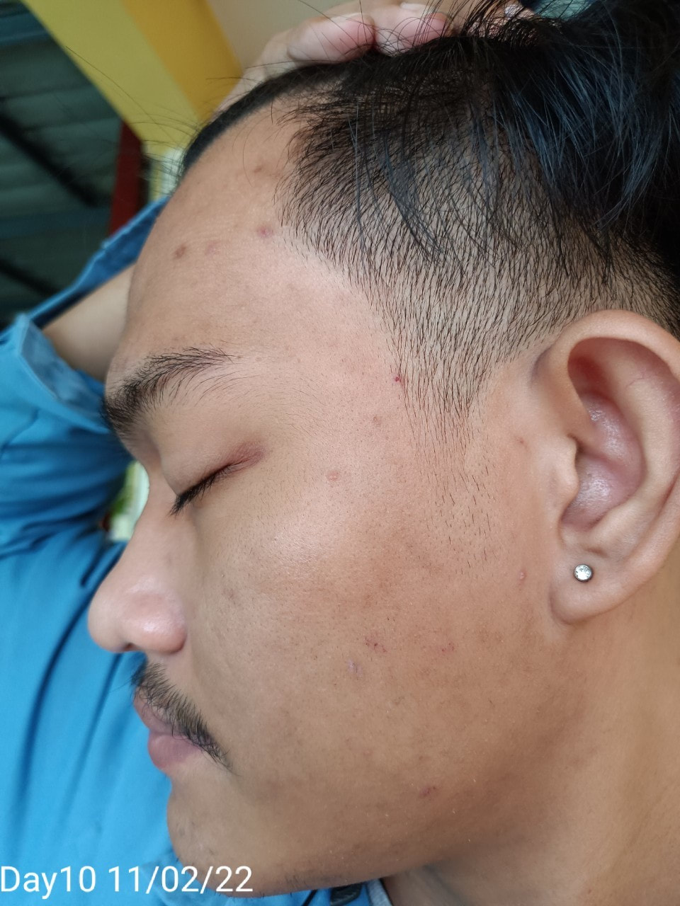 maXkin