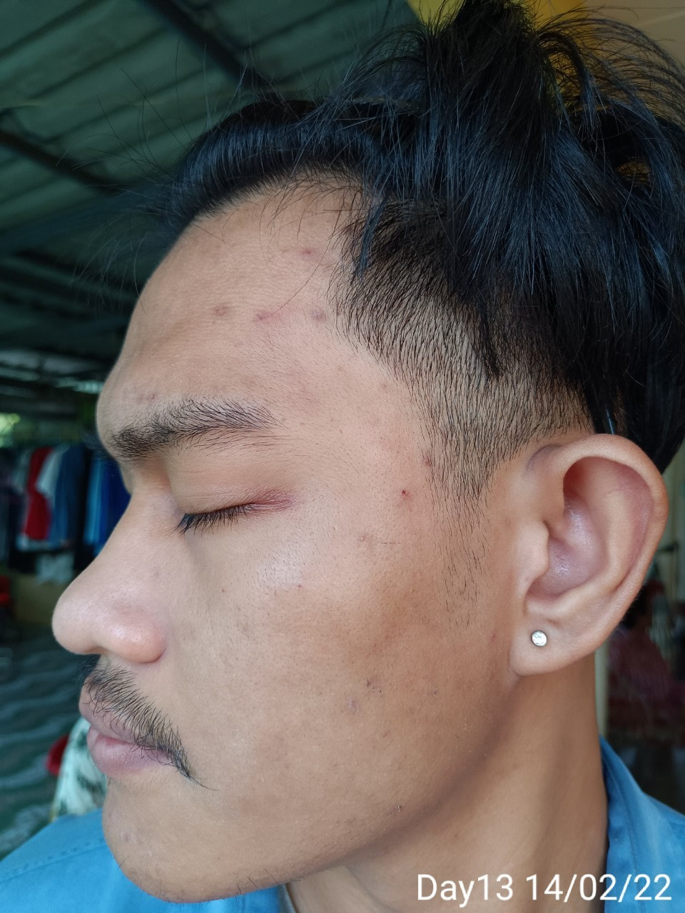 maXkin