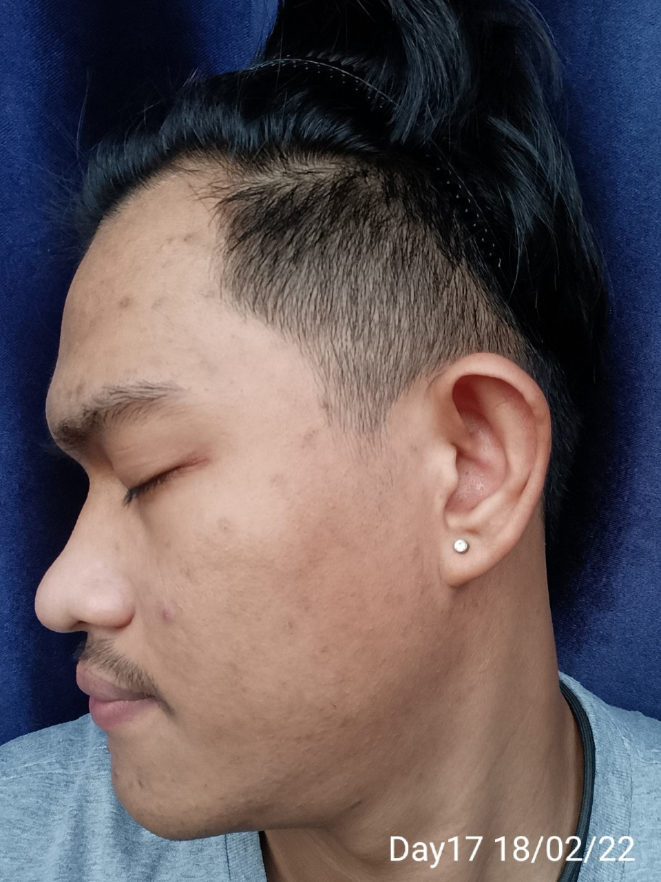 maXkin