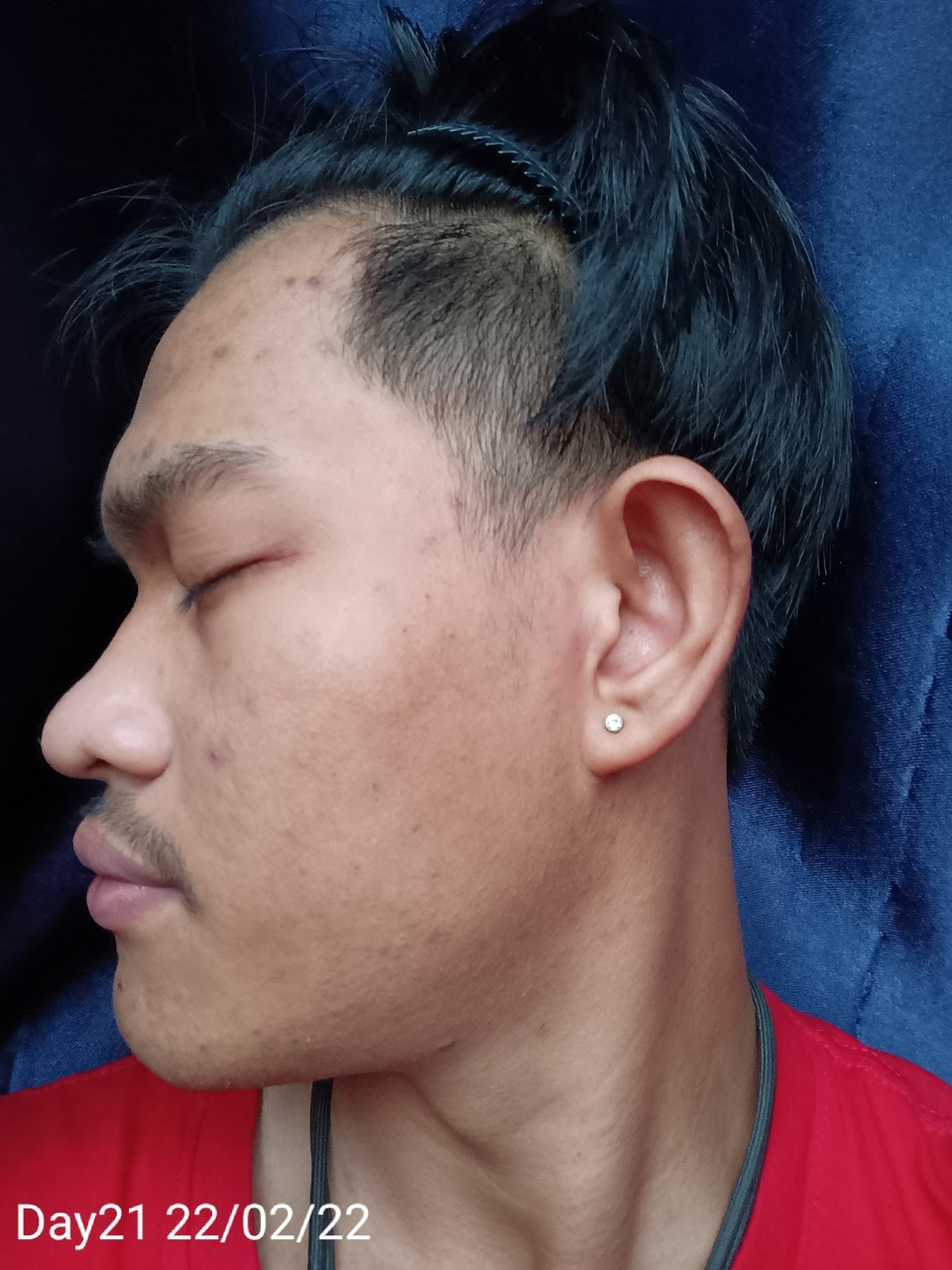 maXkin