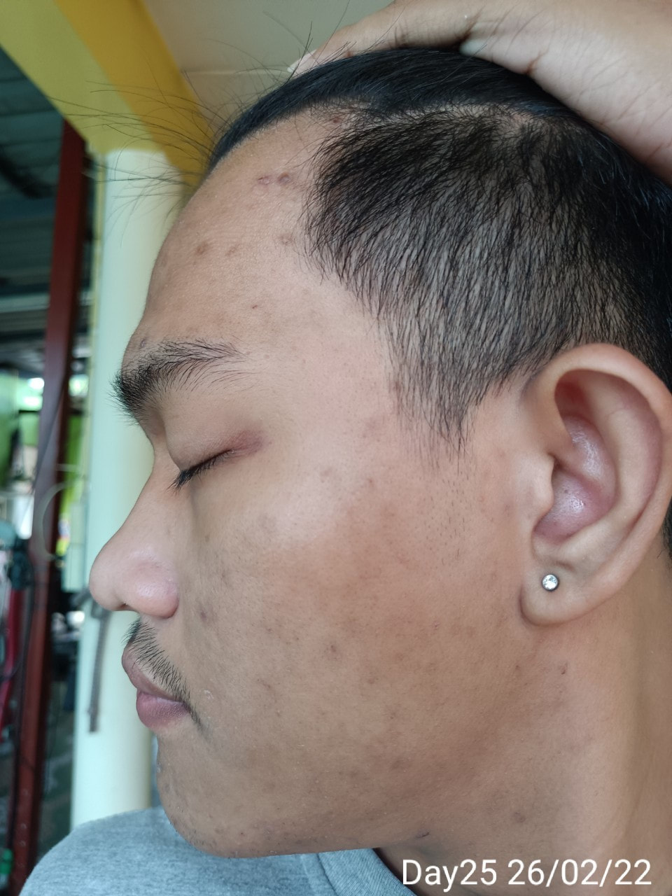 maXkin