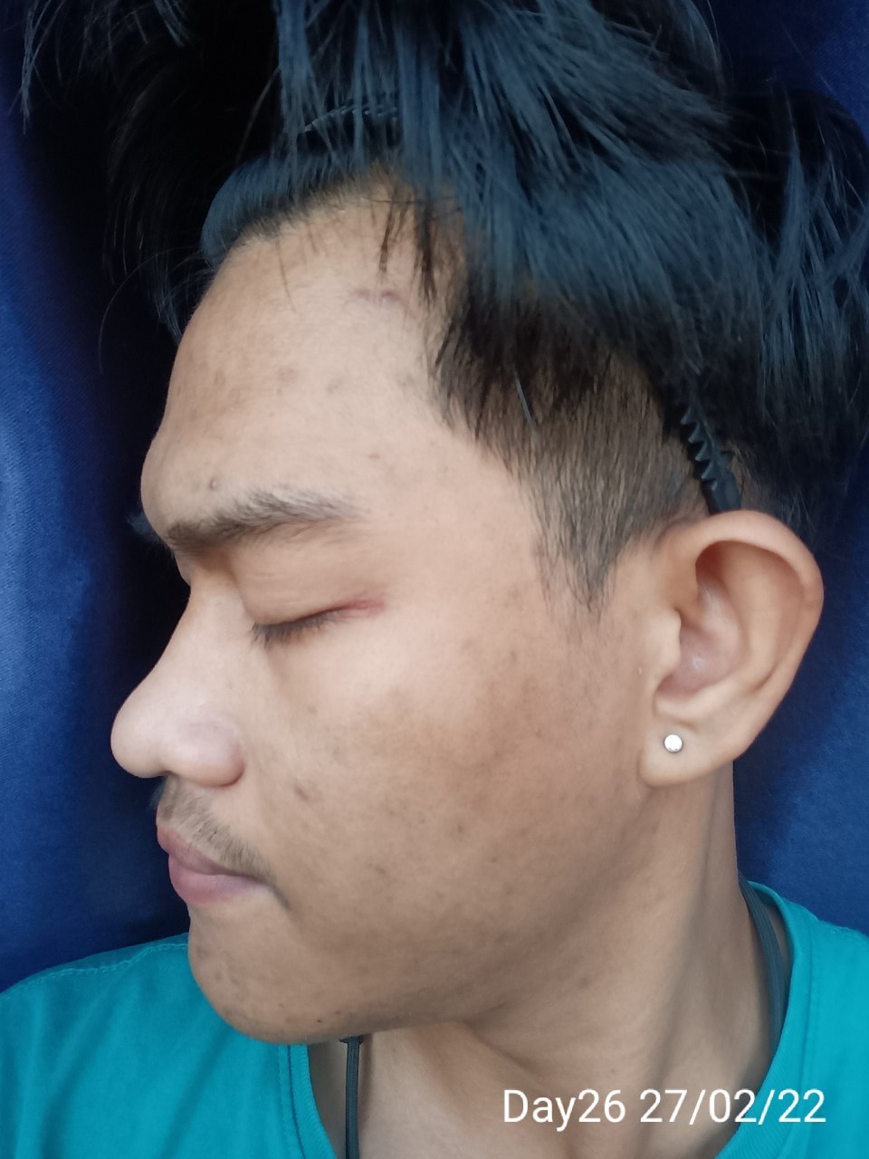 maXkin