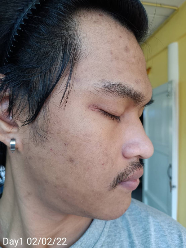 maXkin