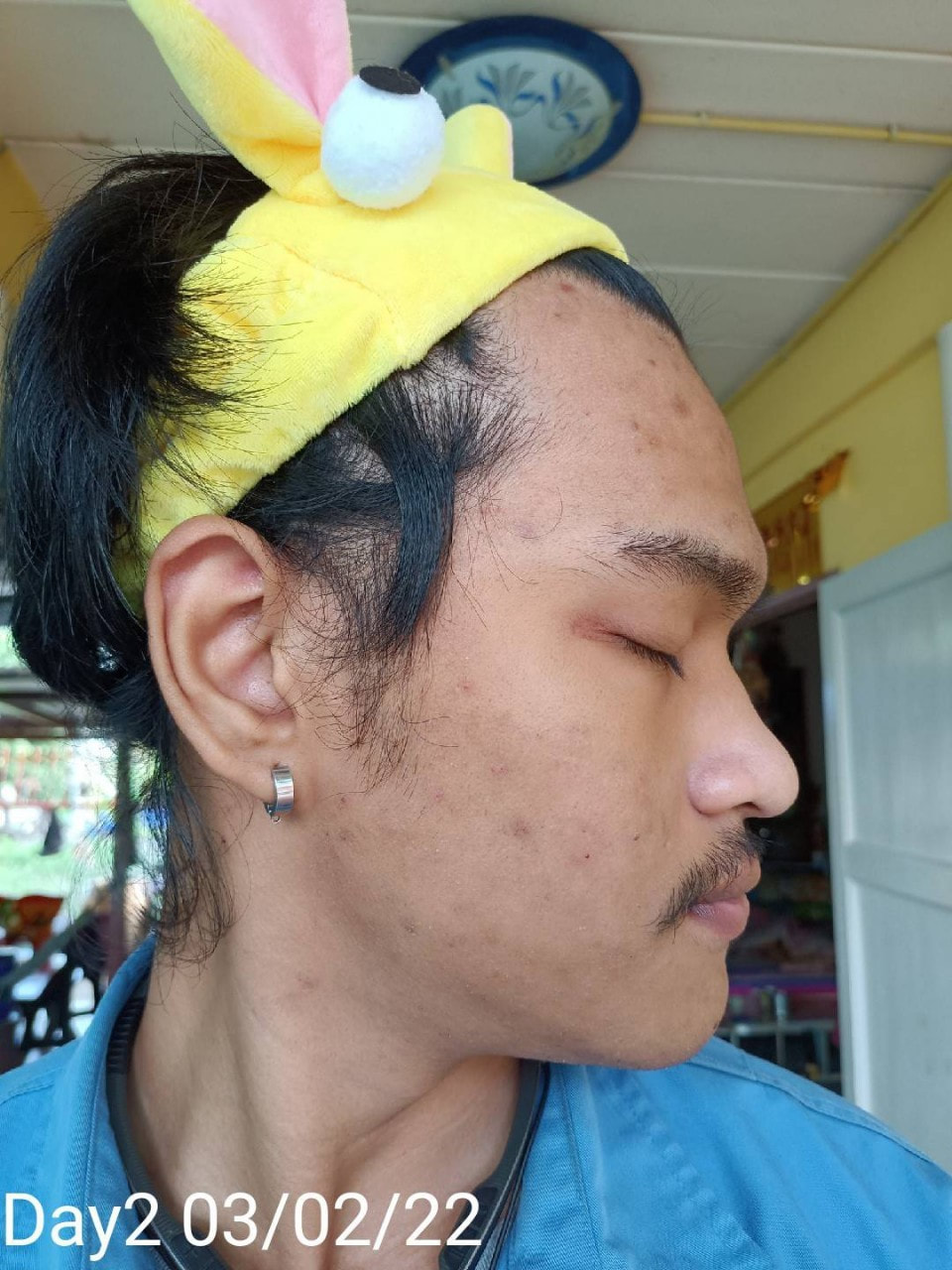 maXkin