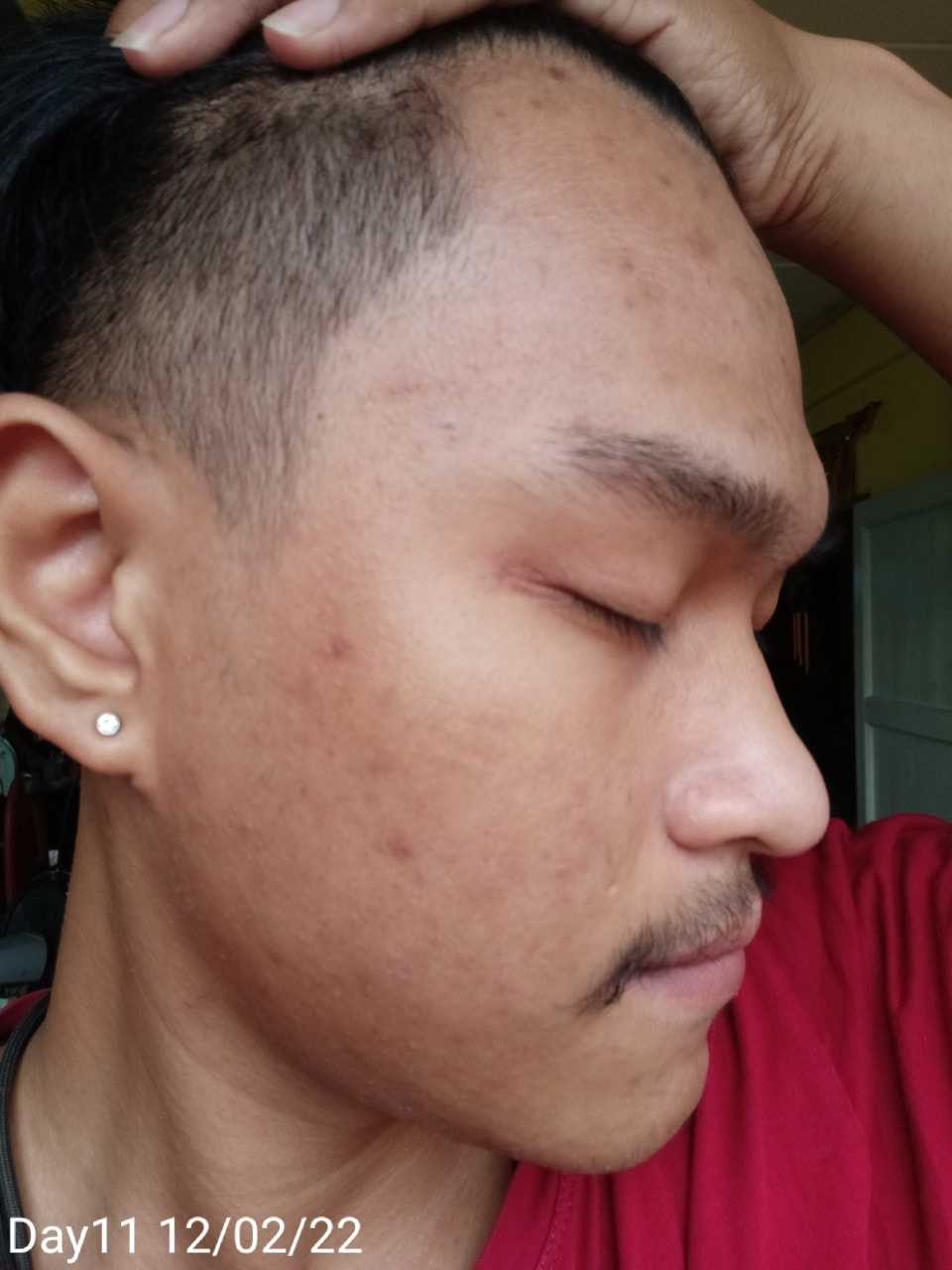 maXkin