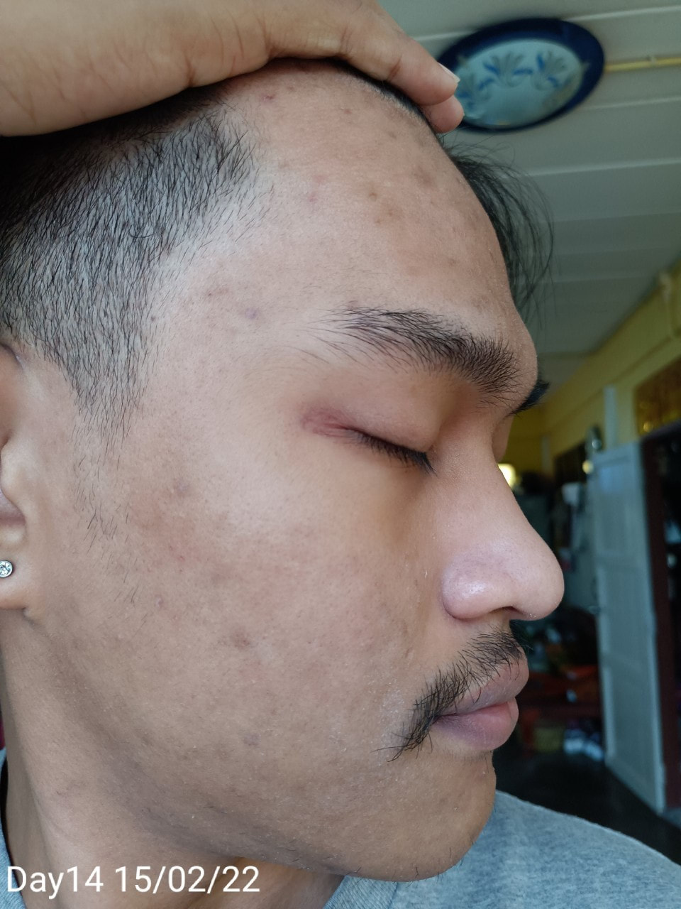 maXkin