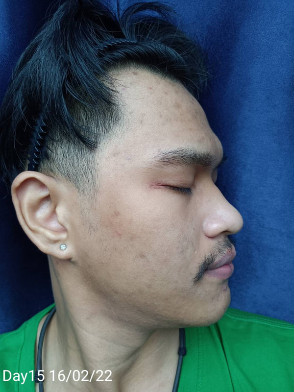 maXkin