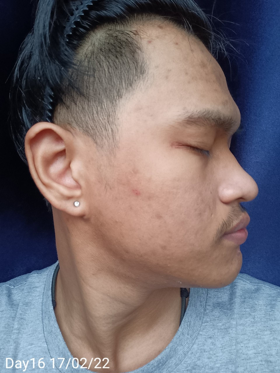 maXkin