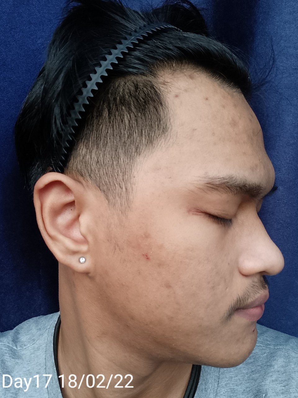 maXkin