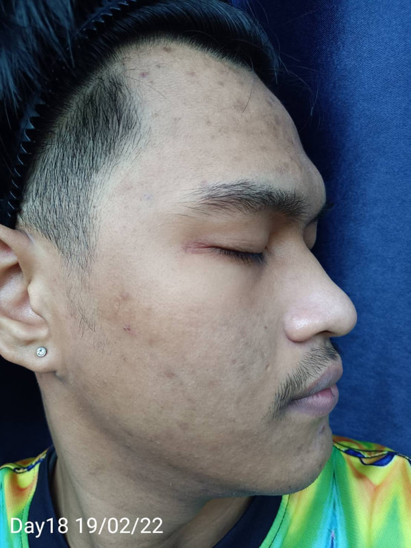 maXkin