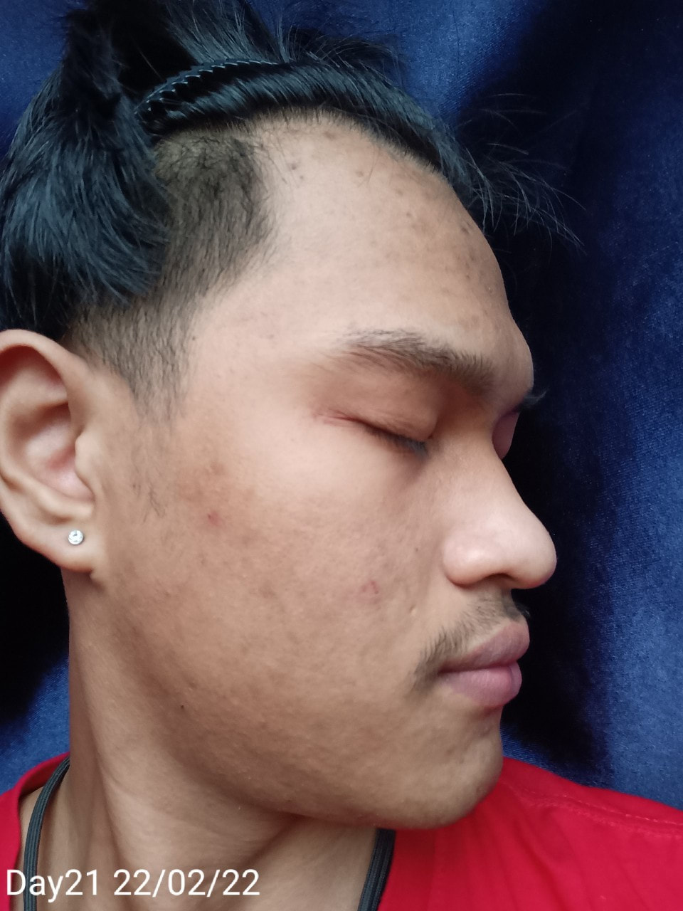 maXkin