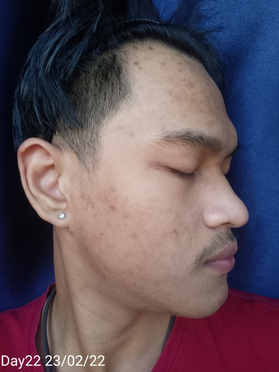 maXkin