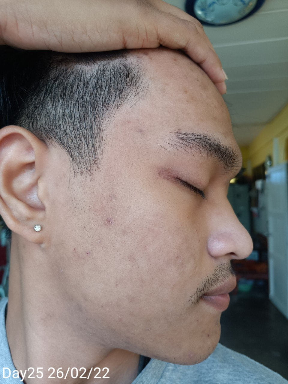 maXkin