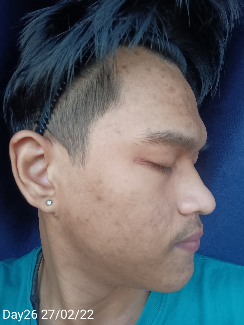 maXkin