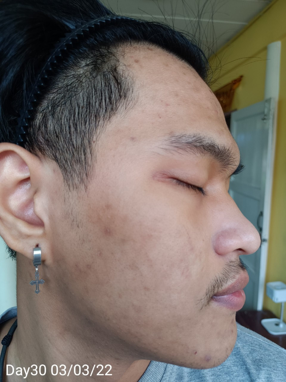 maXkin