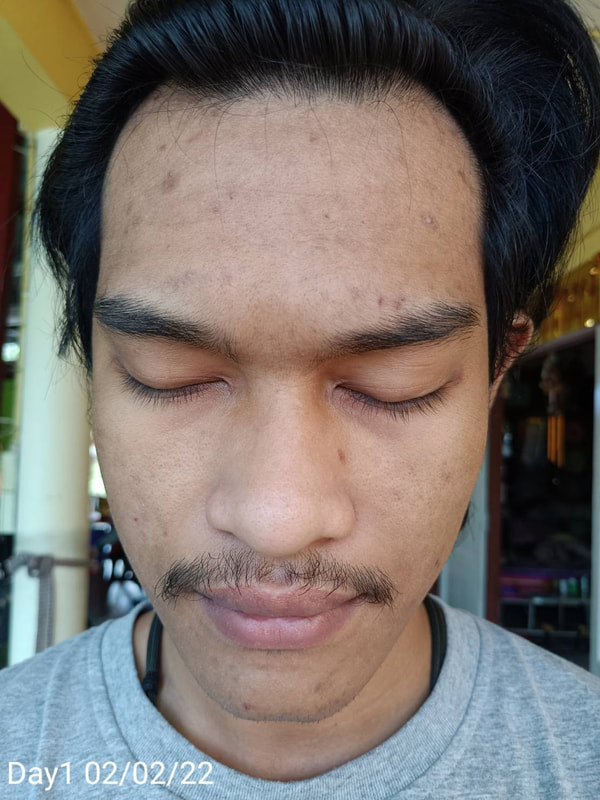 maXkin