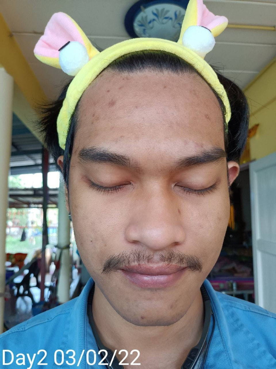 maXkin