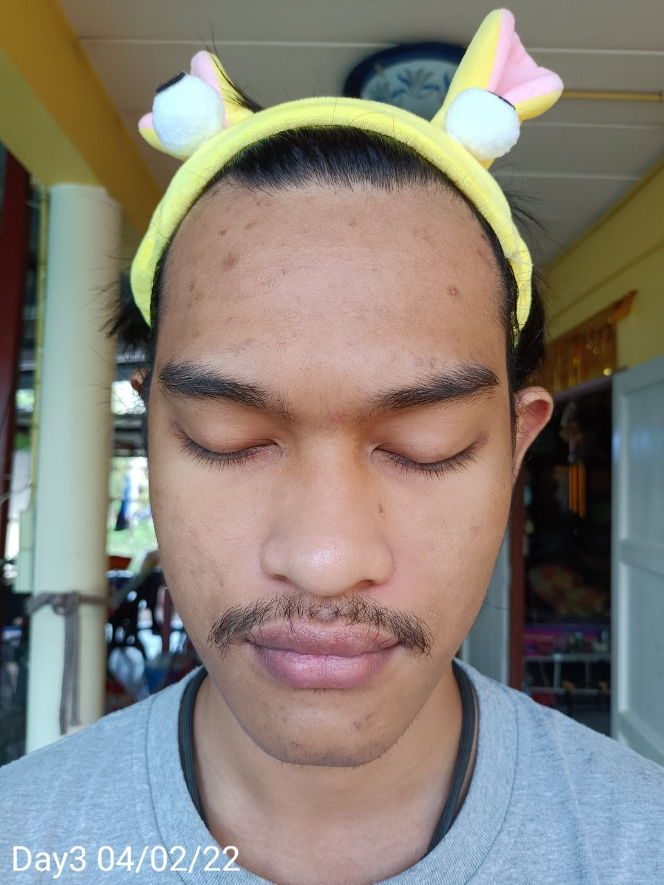 maXkin