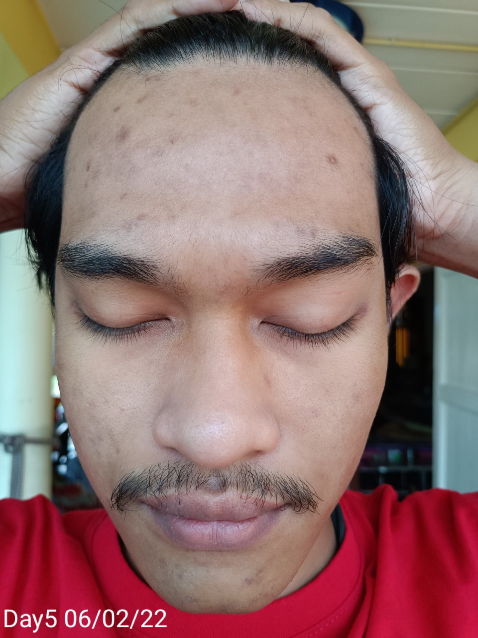 maXkin