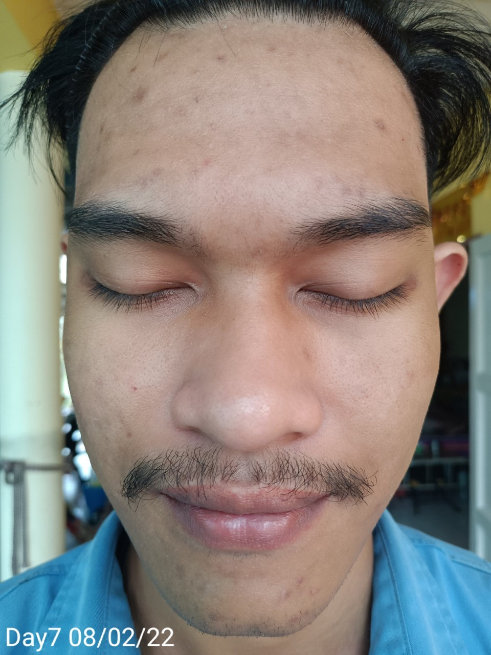 maXkin