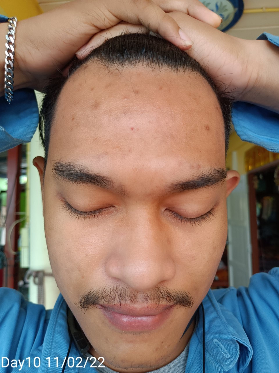 maXkin