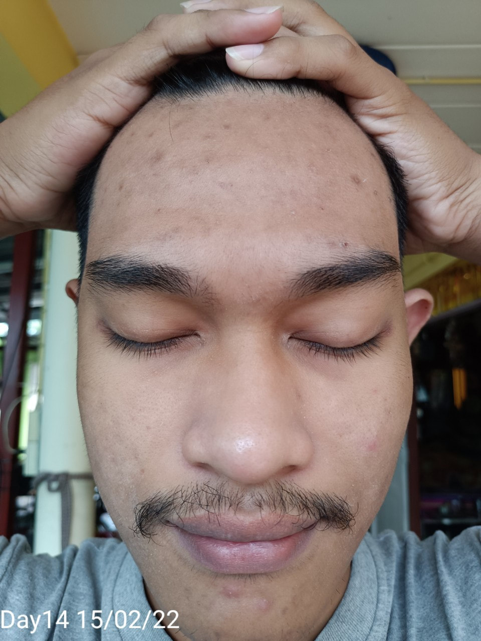 maXkin
