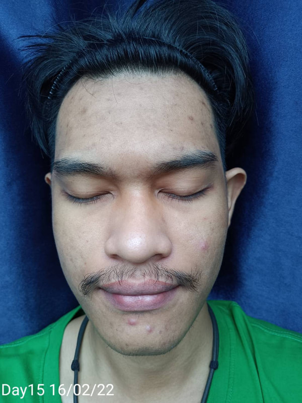 maXkin