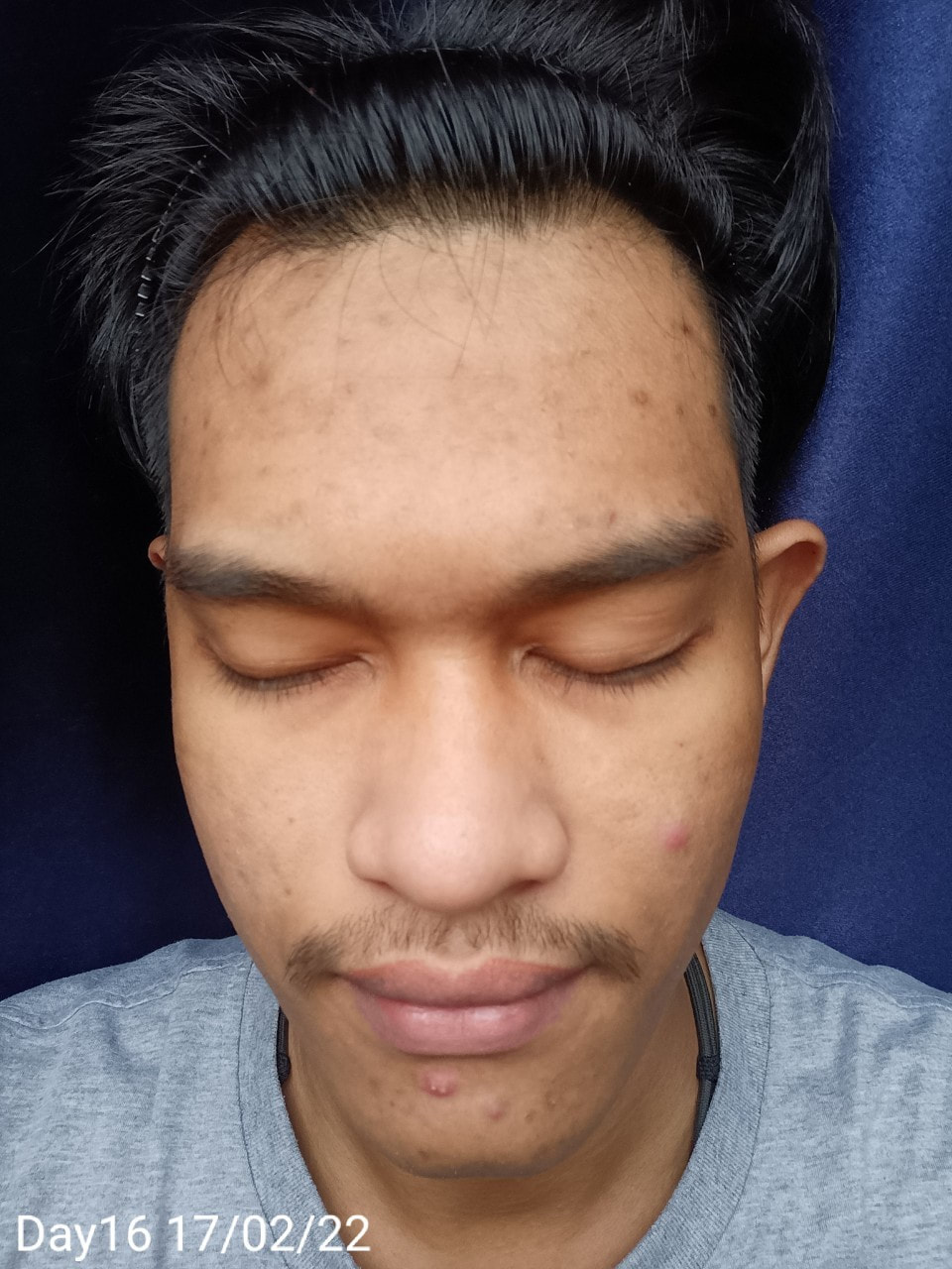 maXkin