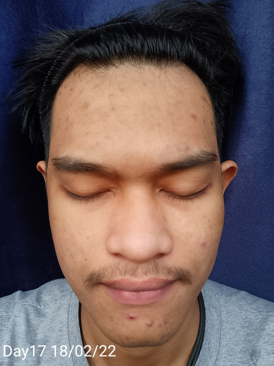 maXkin