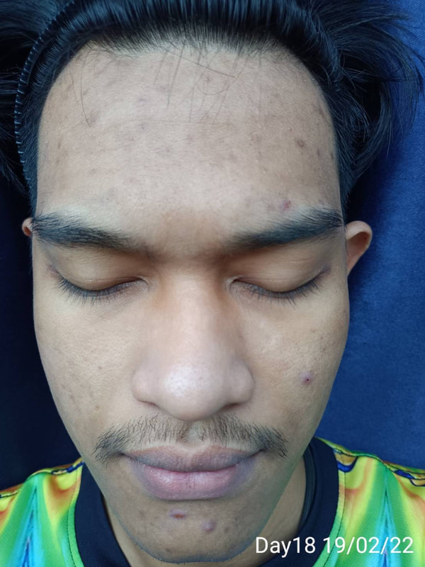 maXkin