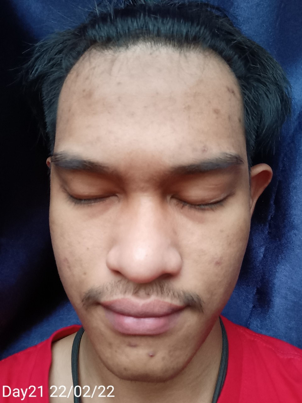 maXkin