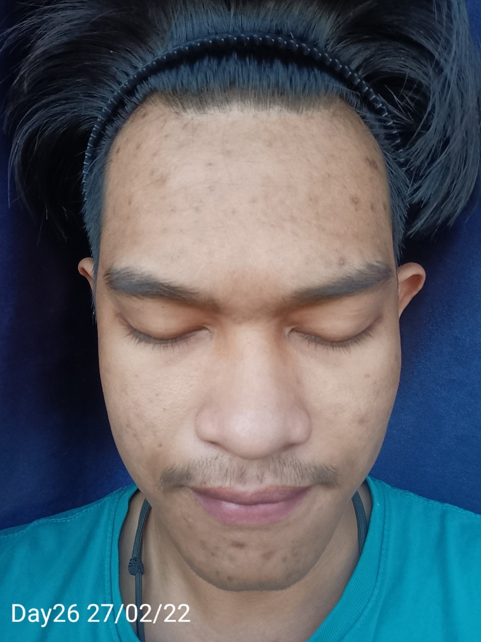 maXkin
