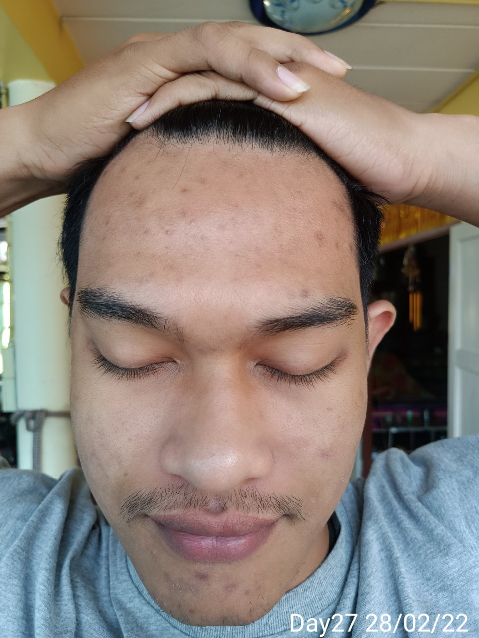 maXkin