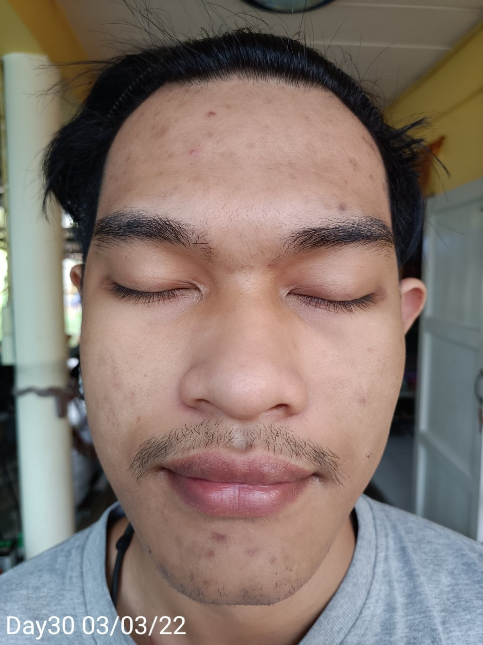 maXkin