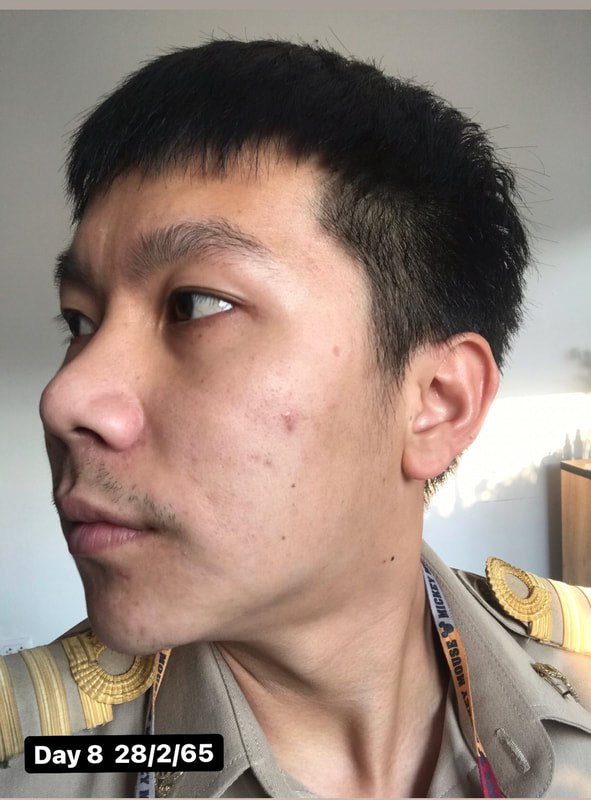 maXkin