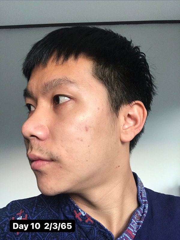 maXkin