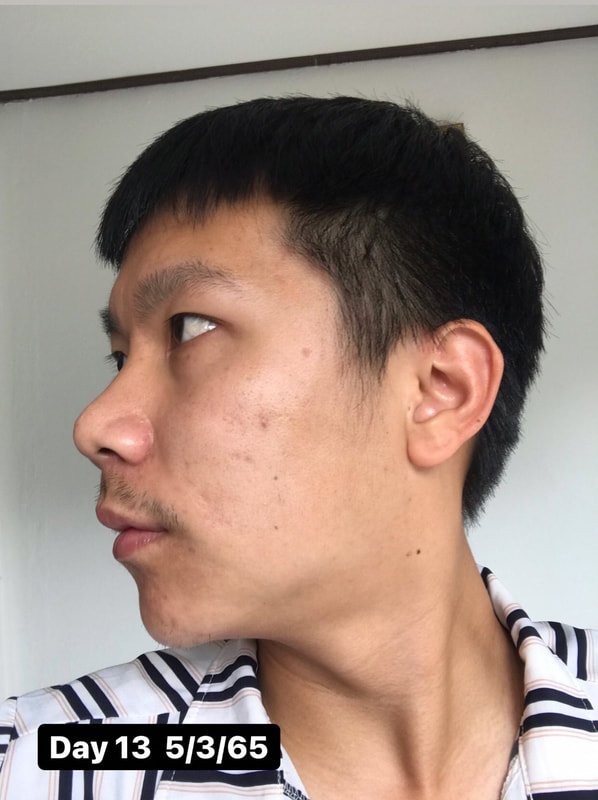 maXkin