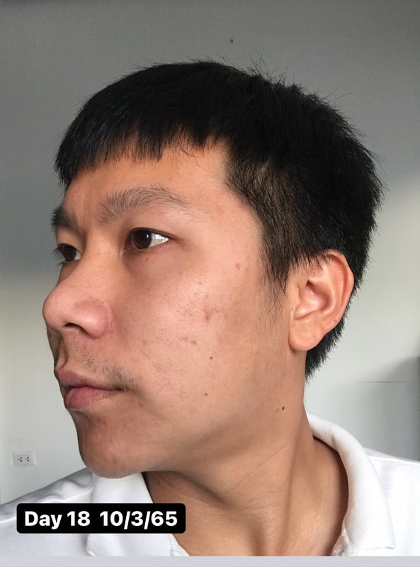 maXkin