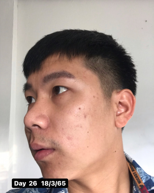 maXkin