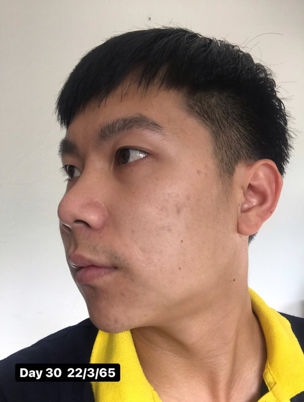 maXkin