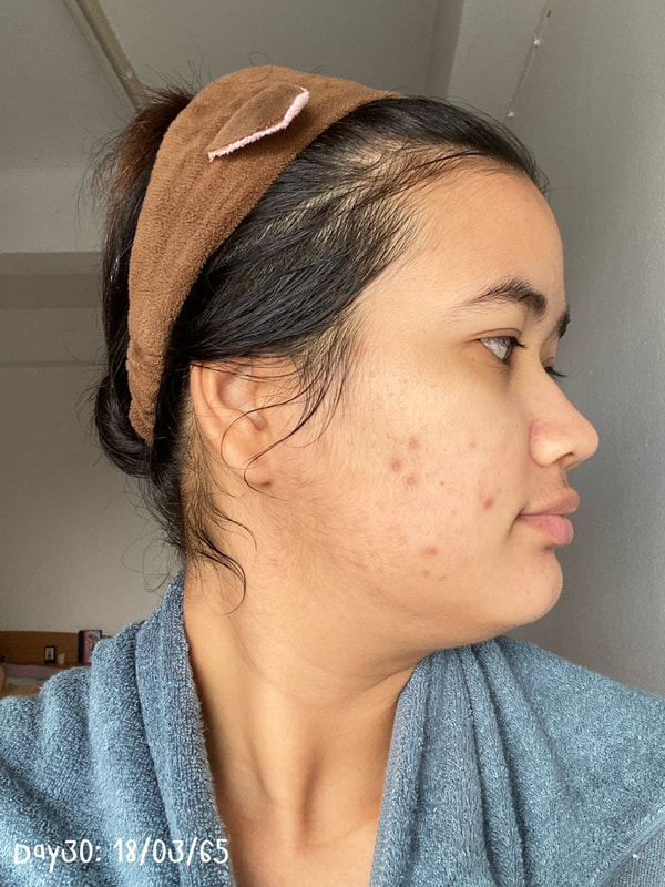 maXkin
