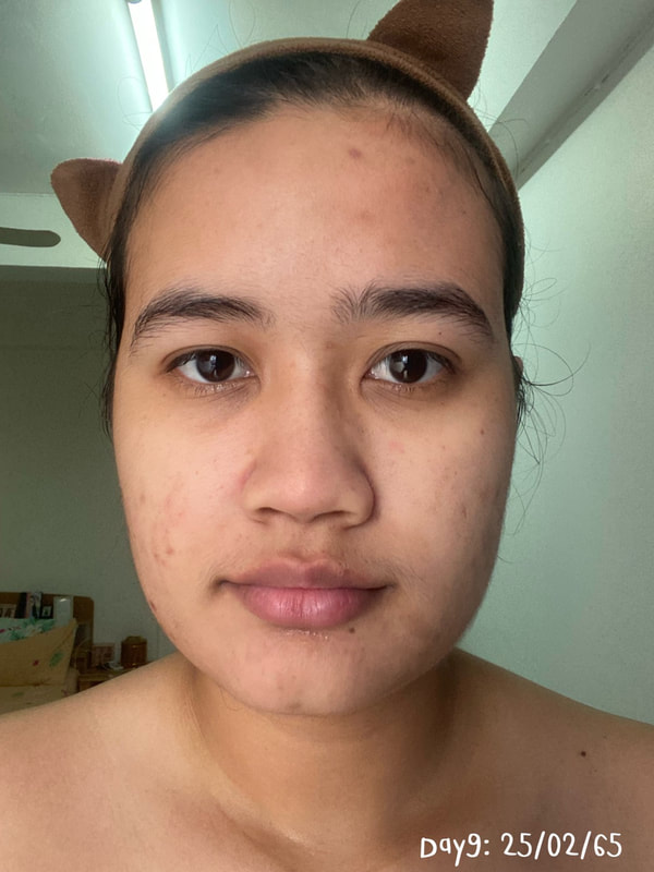maXkin
