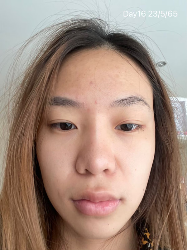 maXkin