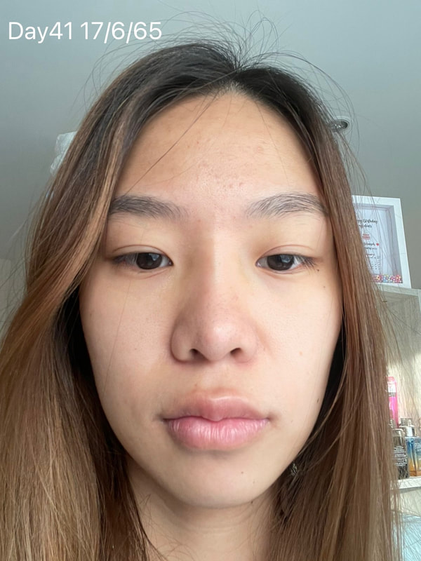maXkin