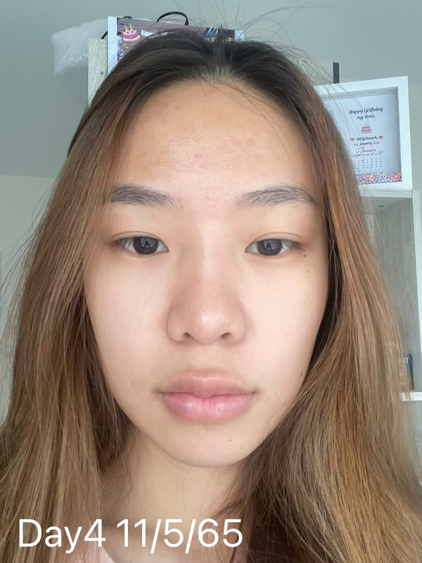maXkin